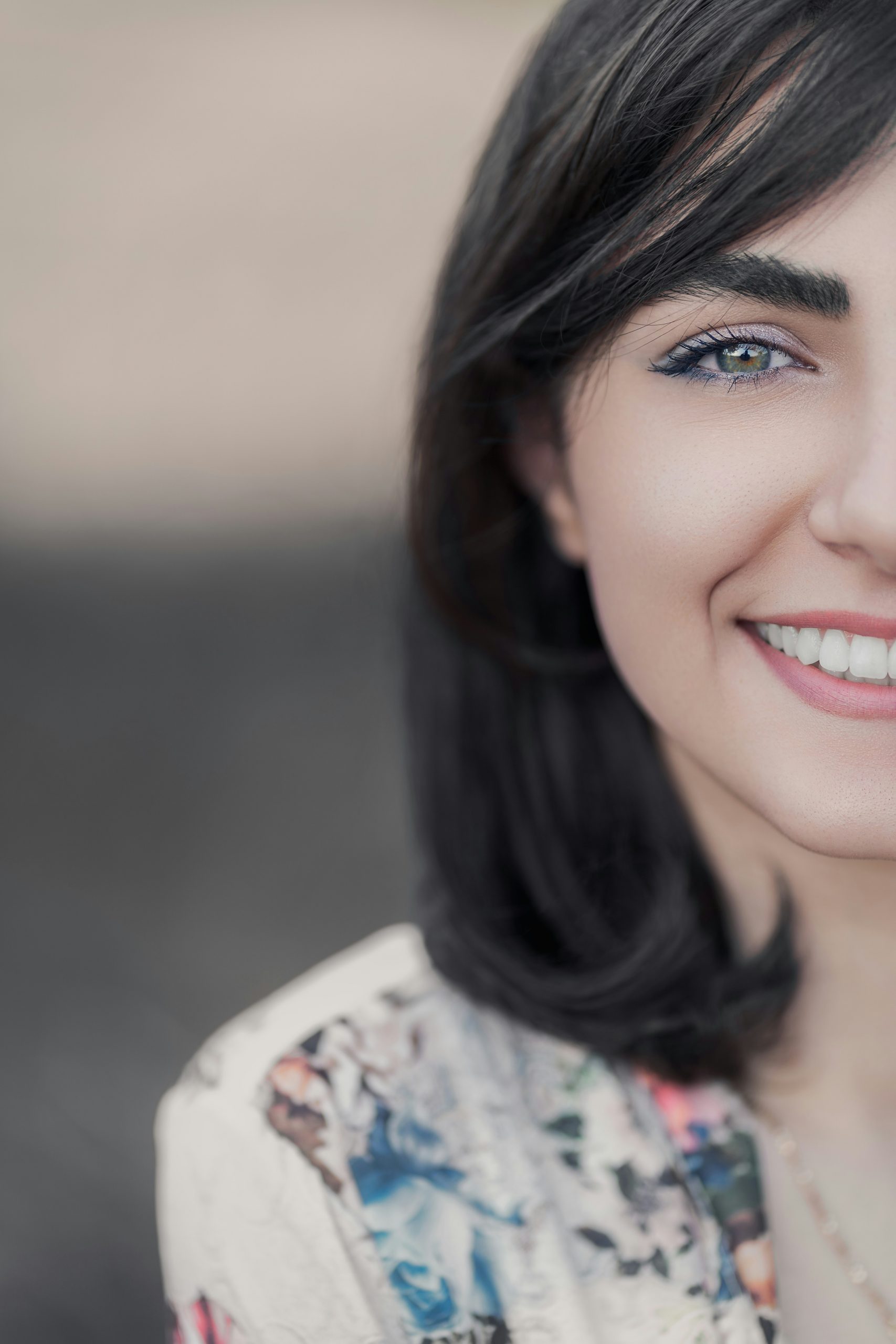 Todo sobre el blanqueamiento dental. Clinica Dental Attitude