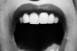 sequedad bucal dental Attitude